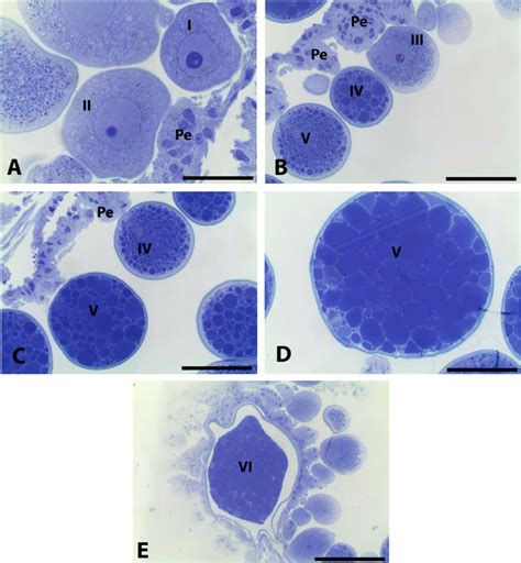 Histological Sections Through Ovaries Of Engorged Females Of