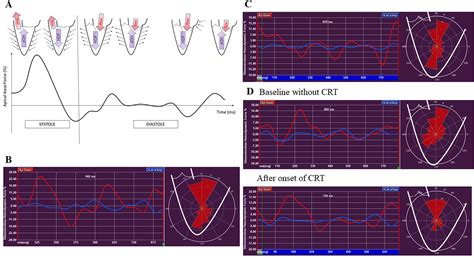 Introduction To Hemodynamic Forces By Echocardiography International