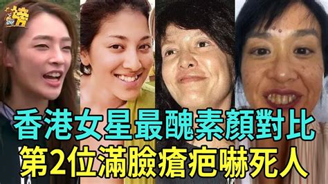 驚恐！香港女星十大最醜素顏對比！第二位滿臉瘡疤嚇死人，最後一位全臉僵硬如蠟像 劉嘉玲 鄭裕玲 鄭秀文 容祖兒 陳凱琳 朱智賢 劉心悠 王君馨 陳楨怡 星聞榜 Youtube