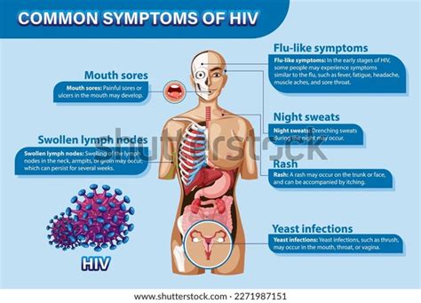 Informative Poster Common Symptoms Hiv Illustration Stock Vector