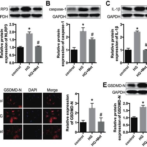 NLRP3 caspase 1 IL 1β and GSDMD N expression levels in vitro Primary