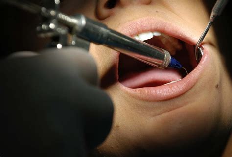 Bologna Scoperto Falso Dentista Con Lo Studio In Pieno Centro