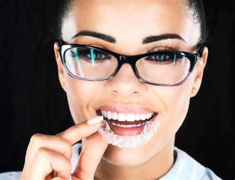 5 Reasons To Choose Invisalign® Over Braces Nazareth Pa Dr Julie Gum