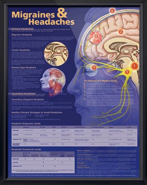 Migraines And Headaches Chart 20x26 Migraine Headaches Migraine Treatment Headache Chart