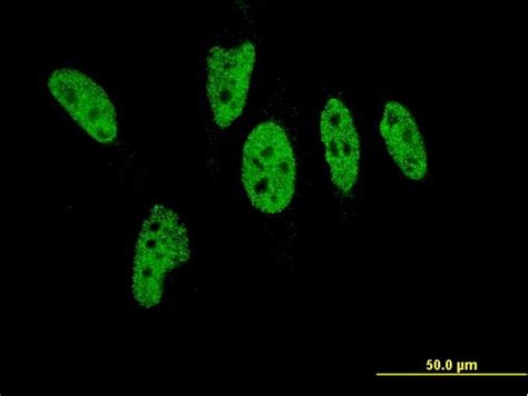 Ihc Plus Ep P Monoclonal Antibody Mouse Anti Human Lsbio