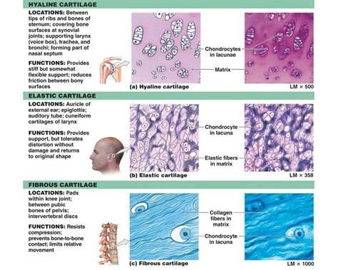 Cartilage Treatment | Cartilage Cell Therapy | Regrow