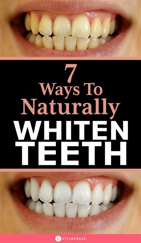 How To Get Rid Of White Spots On Teeth Naturally Mager Guys