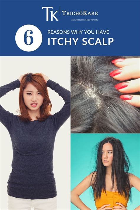 6 Reasons For Itchy Scalp And How To Relieve It In 2020 Itchy Scalp