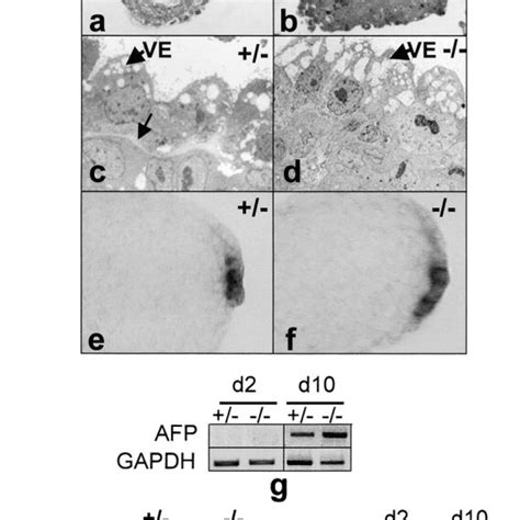 Ve Cell Differentiation And Cavitation In Ebs A And B Toluidine