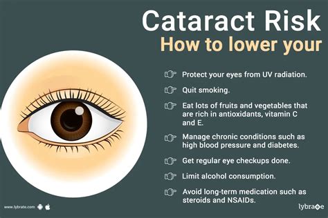 Ways To Lower Your Risk For Cataracts By Dr Manik Lybrate