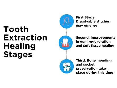 A Brief Guide On Tooth Extraction Healing Stages Kwc Dental