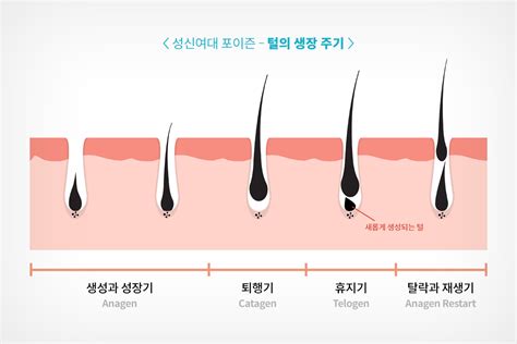 성신여대 피부과 레이저 제모 시술 전날 면도를 해야 하는 이유 성신여대 포이즌 피부칼럼 성신여대피부과 포이즌의원