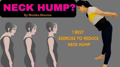 1 Best Exercise To Fix Neck Hump How To Fix Neck Hump Yoga For Neck