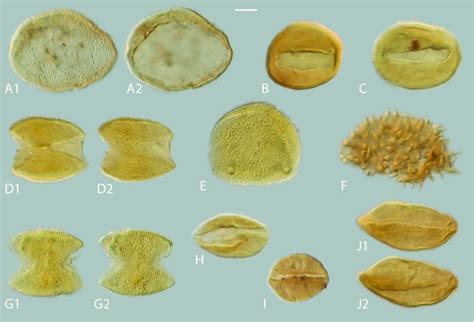 2 Light Microscopy Lm Micrographs Of Palm And Palm Like Pollen Under Download Scientific