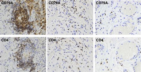 B-and T-lymphocyte staining in bladder submucosa. Immunohistochemistry... | Download Scientific ...