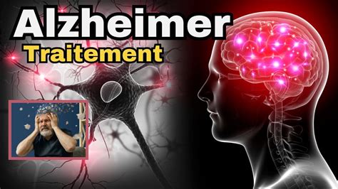 L Alzheimer Tout Savoir Traitements Physiopathologie Recherche