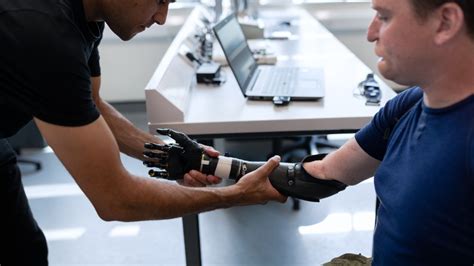 Comparing The Six Types Of Upper Limb Prosthetic Prostheses