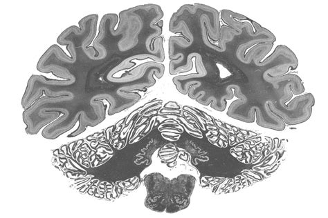 Julich Brain Atlas