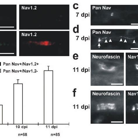 Localization Of Nav Channel Subtypes In Remyelinating Adult Rat Sciatic