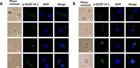 Subcellular Localization Of The Escrt Iii 1 And 22 In Download