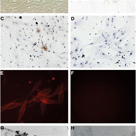 Establishment Of Primary Cell Culture Of Human Glioblastoma Samples