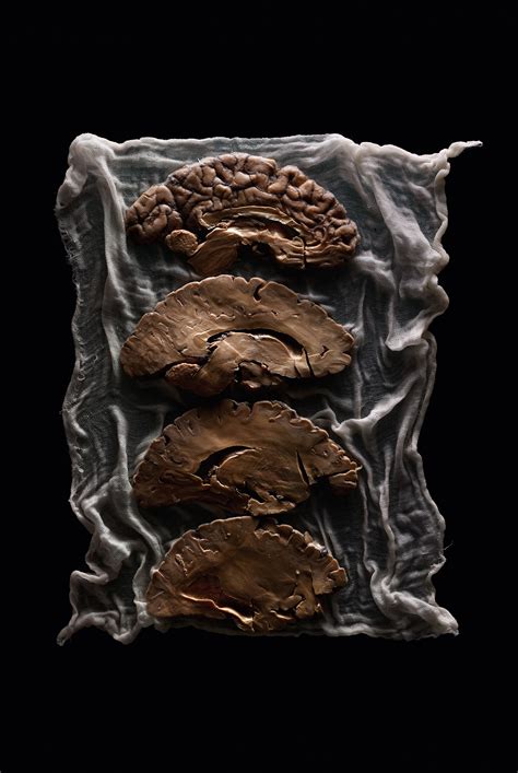 The Odd Beauty Of 60 Year Old Preserved Brains From The Texas State