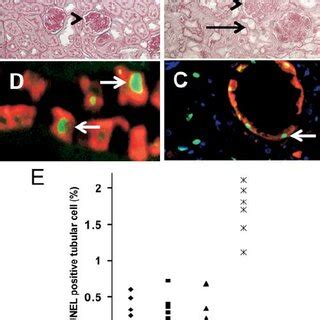 Differential Localization And Expression Of Cd Protein In Kidneys Of