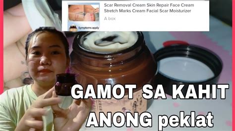 SOLVE ANG PROBLEMA KO ETO NA GAMOT SA KAHIT ANONG PEKLAT PASO PIMPLES