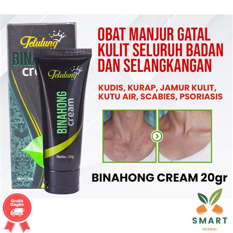 Jual Obat Gatal Selangkangan Obat Gatal Kulit Obat Gatal Kulit