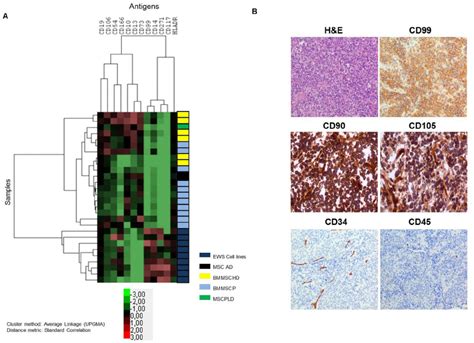 Comparative Study Between MSC EWS Cell Lines And EWS Samples A