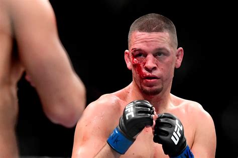 Nate Diaz Wiki Career And Biography Facts Sportsunfold