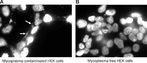 Mycoplasma Contamination Detected In Hek Cells With Dapi Download Scientific Diagram