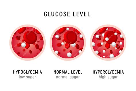 Hipoglicemia E Hiperglicemia - Teste de açúcar no sangue de glicose hipoglicemia de insulina de ...
