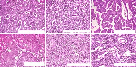 Histology Of Gallbladder