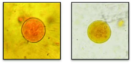 Actual Photographs Of Amoeba Cysts Found In Fecal Samples Download Scientific Diagram