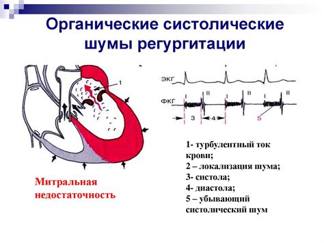 Аускультация шумов сердца. Классификация шумов сердца - презентация онлайн
