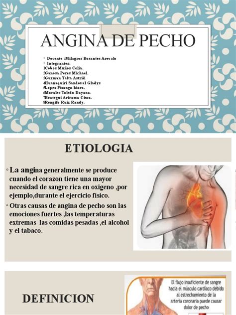 Angina De Pecho Ppt Pdf Enfermedades Y Trastornos Humanos