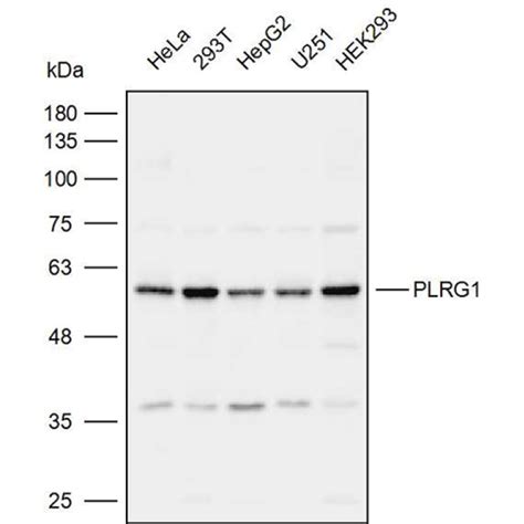 Solarbio K111958P Anti PLRG1 Polyclonal Antibody 试剂仪器耗材