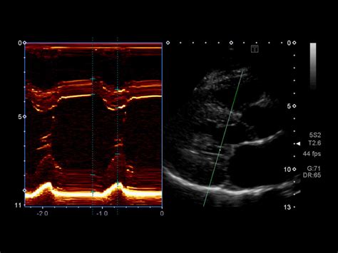 Aplio Flex Veterinary Console Ultrasound