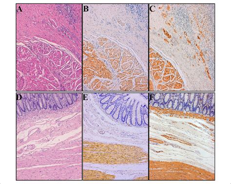 Smoothelin And Smooth Muscle Actin Staining Expression In Download Scientific Diagram