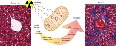 A New Mouse Model Of Radiation Induced Liver Disease Reveals