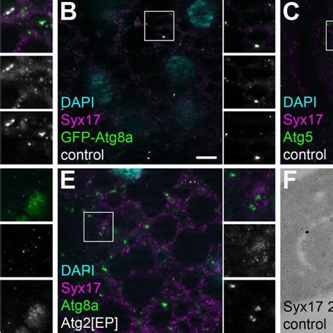 Endosome Maturation Autophagosome Formation And Fusion With Lysosome