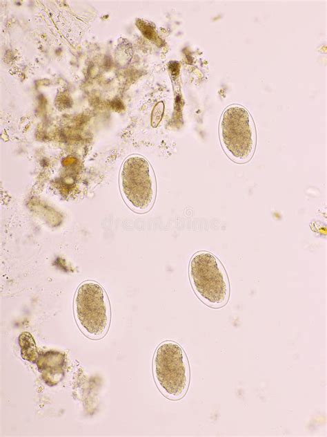 Mix Of Helminths Or Parasitic Worm In Human Stool Stock Photo Image