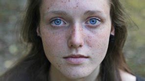 Freckled Porn Pic