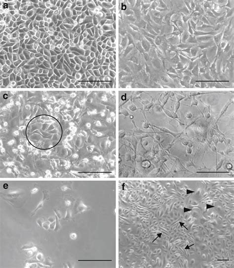 2 Morphology Of Murine Keratinocytes And 3T3 J2 Fibroblast Feeder