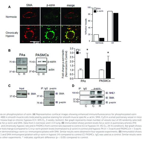 The Effect Of Ezrin Inhibition On Pasmc Function A Immunoblot