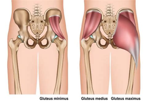 Abductor Repair Gluteus Medius Minimus Treatment Orthopedic Hip