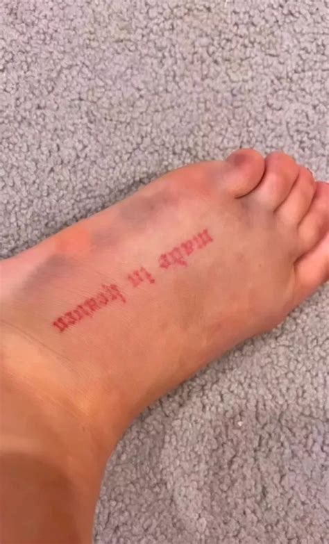 Bikini Clad Paige Vanzant On Crutches After Breaking Foot In Freak