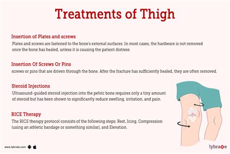 Thigh Human Anatomy Image Function Diseases And Treatments