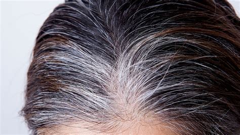 Canas prematuras por qué aparecen y cómo prevenirlas Ser Zen